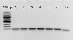 38 Slika 8: Primer elektroforeze produktov gena MPN141 petih vzorcev s pozitivno (k+) in negativno kontrolo (k-) ob markerju 100 bp Slika 9: Primer elektroforeze produktov gena MPN528a petih vzorcev