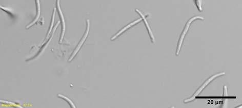 si Slika 1: Acervuli glive Melanconium juglandinum na poganjku navadnega oreha (Foto: Nikica Ogris) Slika 2: Konidiji glive