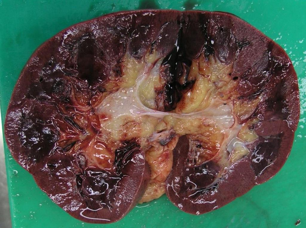Iz ledvičnega meha izhaja sečevod, po katerem odteka seč v mehur. Mehur je zbiralnik za urin, hkrati pa s krčenjem omogoča tudi uriniranje. Iz urina naprej vodi sečnica (Cvetko, 2008).