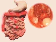 Debelo črevo zavzema daljši del v trebušni votlini, danka pa približno zadnjih 15 centimetrov debelega črevesa.
