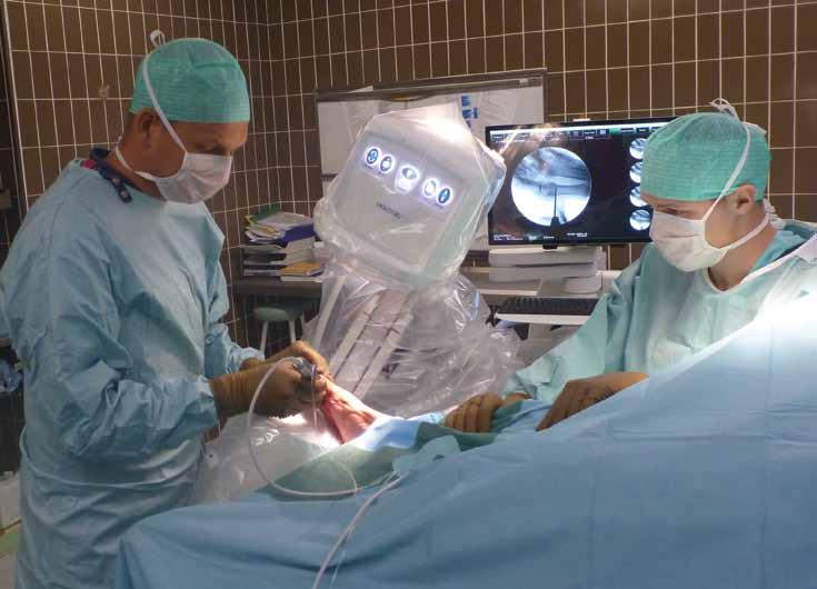 Naša bolnišnica 9 Minimalno invazivna metoda za operativne posege na stopalu sedaj tudi v UKC Maribor Avtor: Matjaž Merc Foto: arhiv Oddelka za ortopedijo Pri težjih deformacijah palca in ostalih