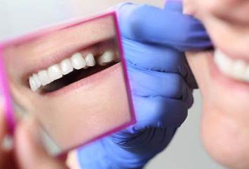Po puljenju zob Po vsakem puljenju zob je treba zaustaviti krvavitev s pomočjo sterilne gaze, ki jo je treba čvrsto držati stisnjeno med zobmi na rani približno 15 minut.