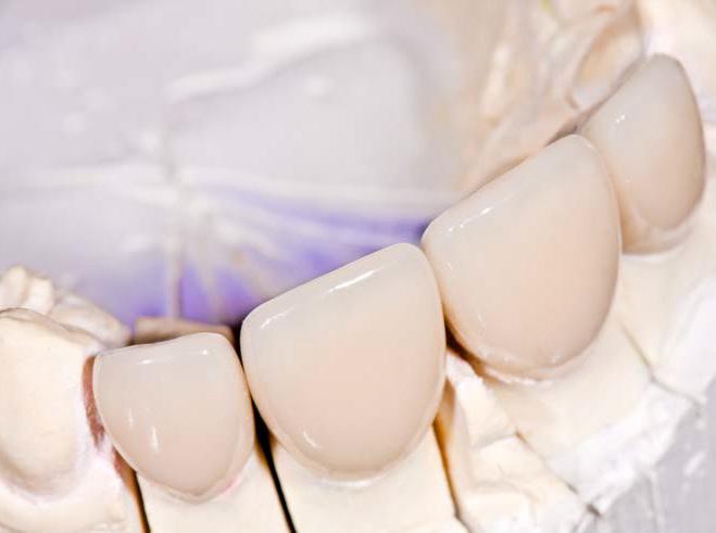 Keramične luske Keramične luske so nadomestki, ki spreminjajo barvo, obliko in položaj zoba.