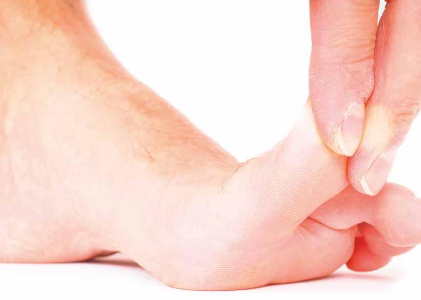 18 Februar 2017 A Pri diabetičnem stopalu je lahko zaznavanje mraza, dotika, vročine, bolečine moteno. B Pozimi mora biti obutev bolnikov mehka, topla, zračna in prostorna.