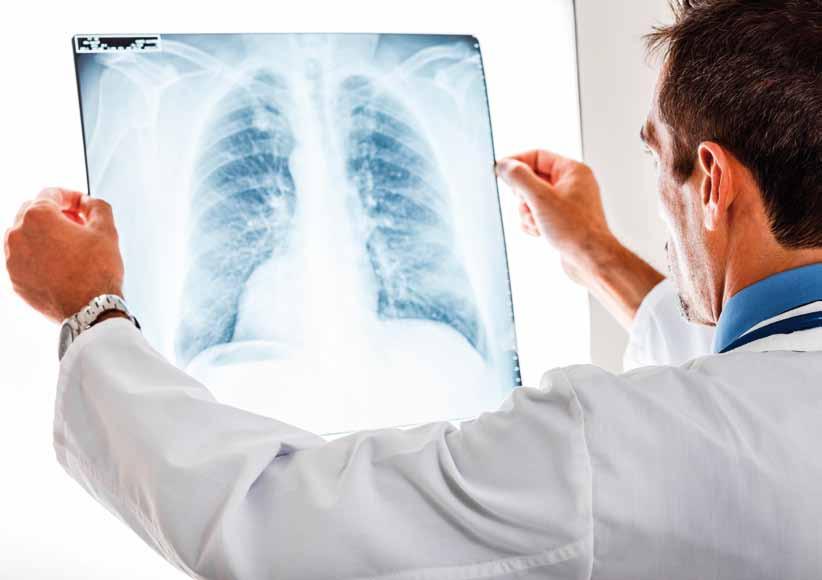 22 Februar 2017 A Najpogostejši vzrok za kronično obstruktivno bolezen je kajenje. B Pri kronični bolezni dihal vsaka okužba pomeni precejšnje poslabšanje pljučne bolezni.