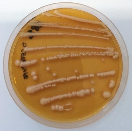 PRILOGA B: Slike trdnih selektivnih gojišč YPD in MRS z izoliranimi čistimi kulturami različnih vrst mikroorganizmov Priloga B1: Slika trdnega
