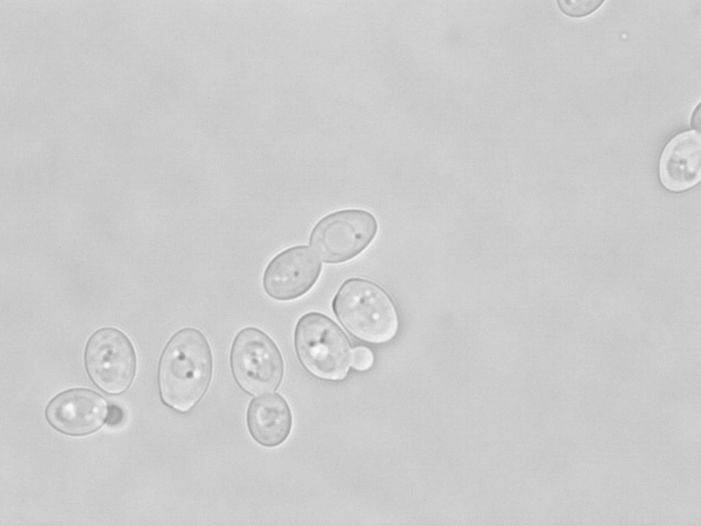 C6: Mikroskopski posnetek kvasovk vrste