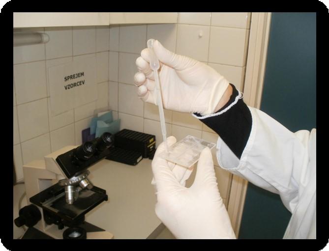 Avtomatski urinski analizator, je polavtomatski laboratorijski pripomoček, ki nam pomaga pri analizi parametrov na testnih urinskih lističih.