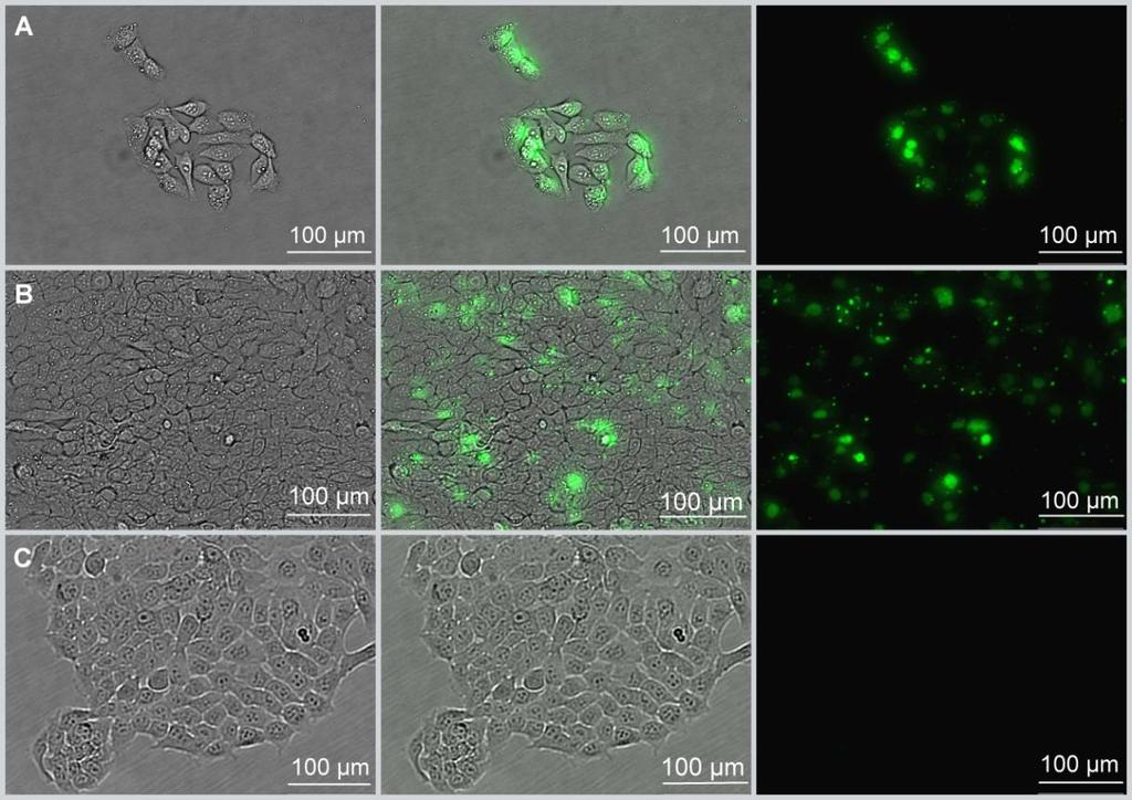3 REZULTATI 3.1 Transfekcija celic HaCaT Uspešnost transfekcije keratinocitov HaCaT smo preverjali s fluorescenčno označenim protismiselnim oligonukleotidom za gen ICAM-1.