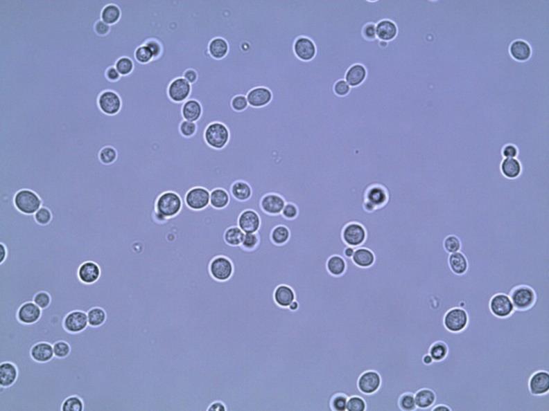Vrsta Rhodotorula mucilaginosa je striktno aeroben organizem, nesposoben fermentacije (Dworecka-Kaszak, 2011, Sponholz, 1992) in je med najpogostejšimi vzroki kontaminacije hrane.