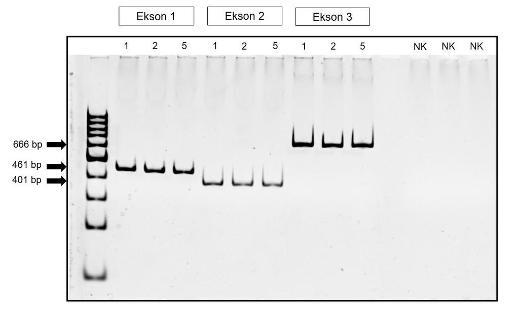35 Slika 15: Pomnoženi odseki gena HBB pri treh osebah z redčeno DNA na poliakrilamidnem gelu. Puščice označujejo velikost posameznih pomnoženih regij.