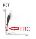 Slika 10: Razsevni diagram retikulocitnega kanala. Slika 11: Razmaz venske krvi (1000x povečava). A) Številčni shizociti.