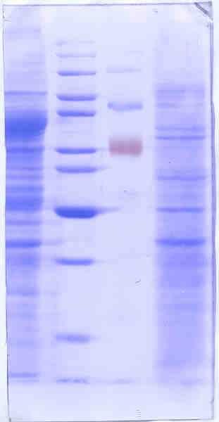 33 4.2 IDENTIFIKACIJA Fc RECEPTORJA V PROTEINSKEM PROFILU M. synoviae Na sliki 10 lahko vidimo profil proteinov M.