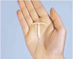 Ženski kondom femidom S progestogenom levonorgestrelom (LNG) IUS