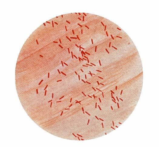 8 2.3 VRSTA Escherichia coli Bakterije vrste E. coli je prvi opisal nemški zdravnik Escherich leta 1885. Escherichia coli je bakterija, na kateri so proučili zgradbo in metabolizem bakterijske celice.