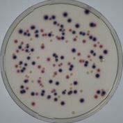 Slika 15: Lactobacillus casei Chromocult Coliform Agar Trdno gojišče združuje dva kromogena substrata, ki omogočata detekcijo skupnega števila koliformnih bakterij in E. coli.