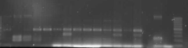 1 2 3 4 5 6 7 8 9 10 11 12 13 14 15 P N M 14 15 16 17 18 19 20 21 22 23 24 25 26 27 28 P N M Slika 21: Pomnožki multiplex PCR, s katerim smo dokazali sev E.coli O157:H7.