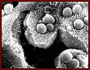 Slika 2 7: Izgled ciste Cryptosporidium pod elektronskim mikroskopom na sluznici črevesa (levo) in v fazi excistacije, ko spusti v okolje 4 spore (desno) [12].