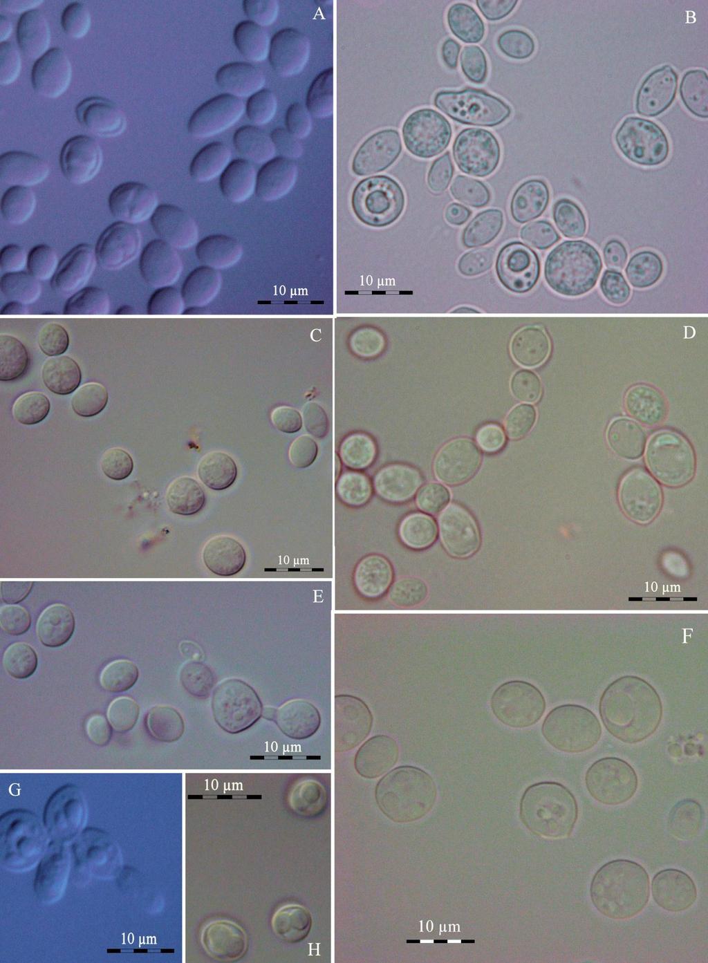 53 Slika 14: Posamezne kvasne celice različnih sevov S.