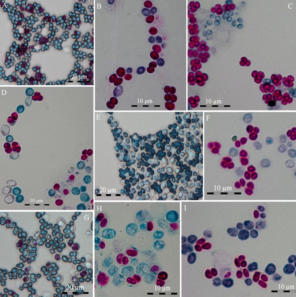 54 Slika 15: Mikrografije mikroskopskih preparatov po acidorezistentnem barvanju sevov S. cerevisiae pod različnimi povečavami (400, 1000 ; merilca so na posameznih slikah).