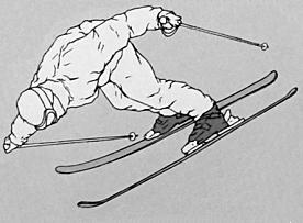 Slika 3: Mehanizem poškodbe notranje stranske (kolateralne) vezi (Knee Injuries and Tele Skiing: More Research Is Needed, 2002). Golenica in mečnica sta kosti v goleni.