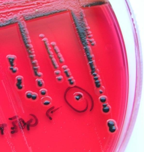 11 Slika 1: Kolonije bakterije Salmonella enterica subsp. enterica na selektivnem gojišču XLD. (Foto: M. Farkaš) Bakterije so patogene tako za ljudi, kot za živali.