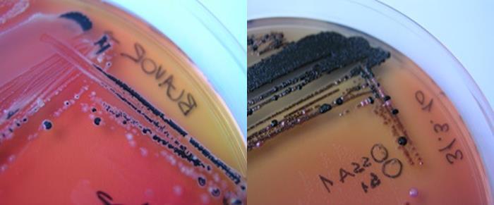 21 Slika 4: Mešana kultura s kolonijami potencialnih salmonel na selektivnih in diferencialnih trdnih gojiščih XLD (levo, rožnate kolonije s črnim centrom) in SSA (desno, prosojne kolonije s črnim