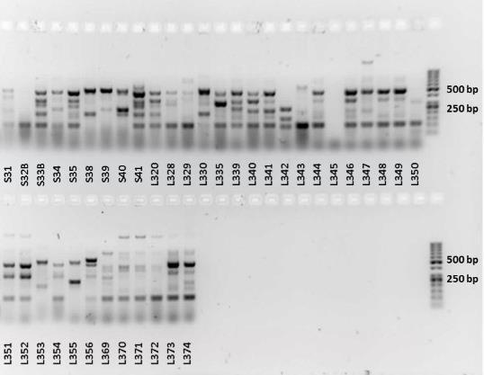 42 Slika 9: Agarozni gel po elektroforezi z nanešenimi pomnožki PCR za ugotavljanje prisotnosti genov beta-laktamaz (ESBL) skupine CTX-M.