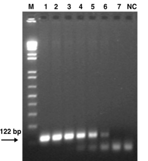 21 Pomnožek, specifičen za določanje ovčje DNA, je bil velik 371 bp. Za določanje koze so uporabili začetna nukleotida (López-Calleja in sod., 2005a): a. 12SM-FW: 5 -CTAGAGGAGCCTGTTCTATAATCGATAA-3, b.