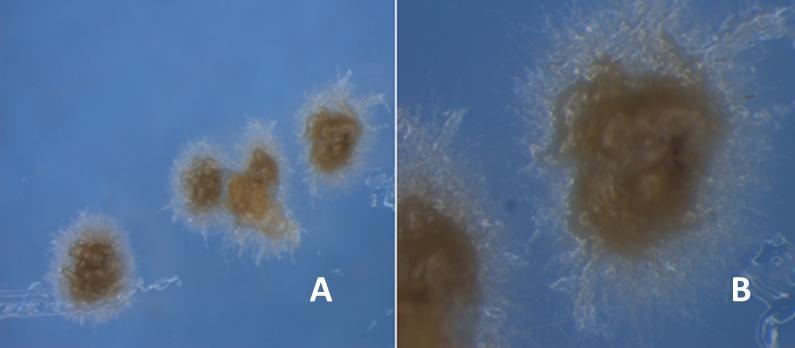 Kolonije izolata 045/02 na SNA gojišču so sluzaste, temno rumene barve, intenzivno tvorijo trose, zračnega micelija ni, na robu kolonije se hife radialno razraščajo po površju agarja (Slika 19A).