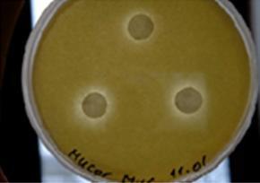 Slika 40: Vpliv ekstrakta glive M. tardicrescens na filter diskih na glivo Mucor hiemalis Figure 40: Effect of fungal extract from the fungus M.