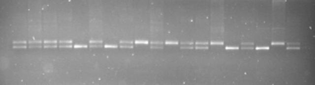 33 sledi FF, FL, FF, FL, LL, itd za marker D15Mit261 na preučevanem Fob3b odseku kromosomu 15. F L F1 Slika 3: Agarozni gel na katerem so naneseni vzorci, ki so genotipizirani za marker D15Mit261.