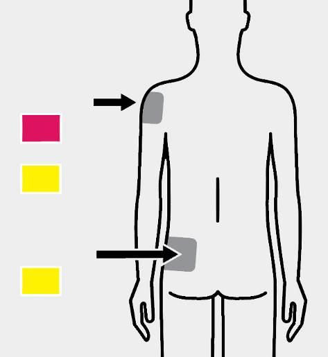 3 Injiciranje Injicirajte odmerek deltoidna mišica rožnati nastavek ali rumeni nastavek glutealna mišica rumeni nastavek