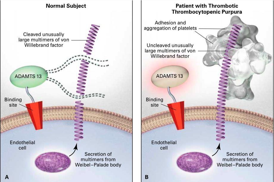 Patofiziologija TTP Prirojena TTP=mutacija v genu za ADAMTS13 Upshaw schulman sindrom-redko!