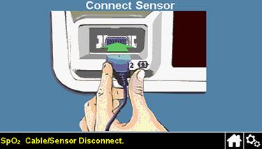 Če se senzor odklopi s sistema za spremljanje Če se senzor odklopi s sistema za spremljanje, se pojavi zaslon,