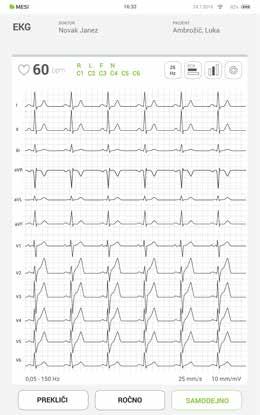 32 PODROBNA NAVODILA 10. korak Ko je EKG-signal jasen in stabilen, pritisnite gumb Auto, da samodejno shranite zadnjih 10 sekund EKG-posnetka.