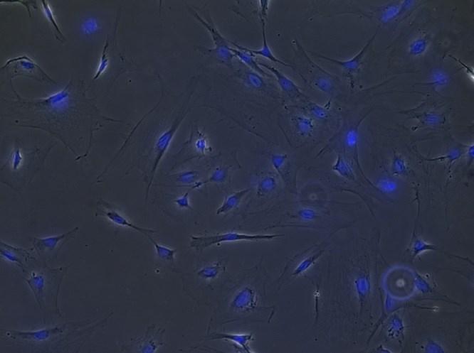 38 A B C Č D E Slika 19: Imunocitokemija na mišjih MMC proti oznaki