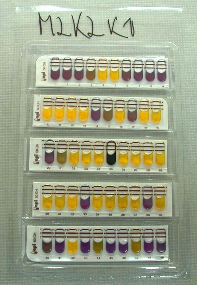 41 3.2.4.3 API CH 50 Test API test se uporablja za identifikacijo bakterij glede na ogljikove hidrate, ki jih fermentirajo.