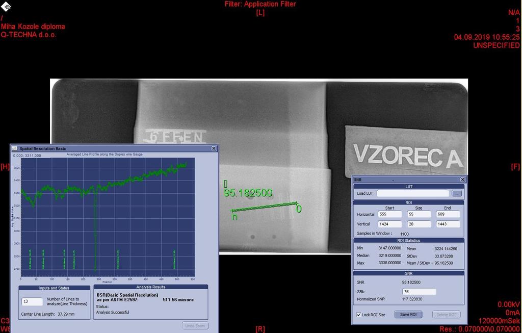 4.1.3 Rezultati digitalne radiografije z izotopom Ir 192 Rezultati in diskusija Tudi pri digitalni radiografiji smo morali najprej izbrati primerne parametre za naš vzorec.