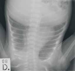 diagnostična radiologija Glede na tehnično kakovost in diagnostično uporabnost je slike ovrednotil radiolog - pediater.