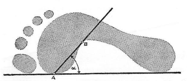 - Clarkova metoda Najprej narišemo tangento AC, ki povezuje točki notranje strani stopala. Nato določimo točko B, ki označuje presečišče vzdolţnega in prečnega loka stopala.