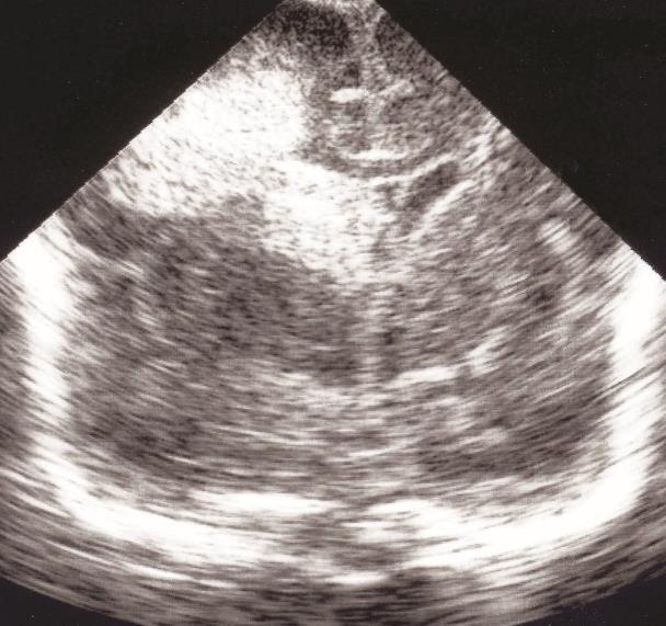 Vzroki za neonatalno obolevnost KO za perinatologijo Lj,