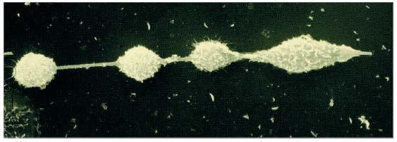 Azbesti, kvarz, vlakna, nanocevke, nanožice Vnetje, prihod makrofagov, zabrazgotinjenje, pljučni