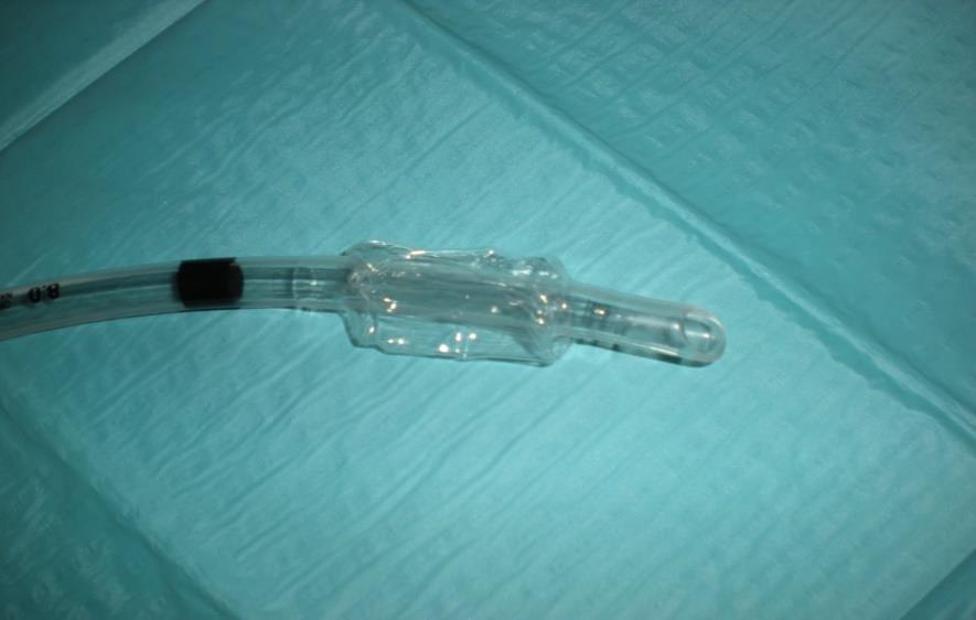 Slika 1: Prikaz praznega mešička dihalne cevke Vir: Radolič, 2015 Slika 2:Dihalne cevke različnih velikosti Vir: