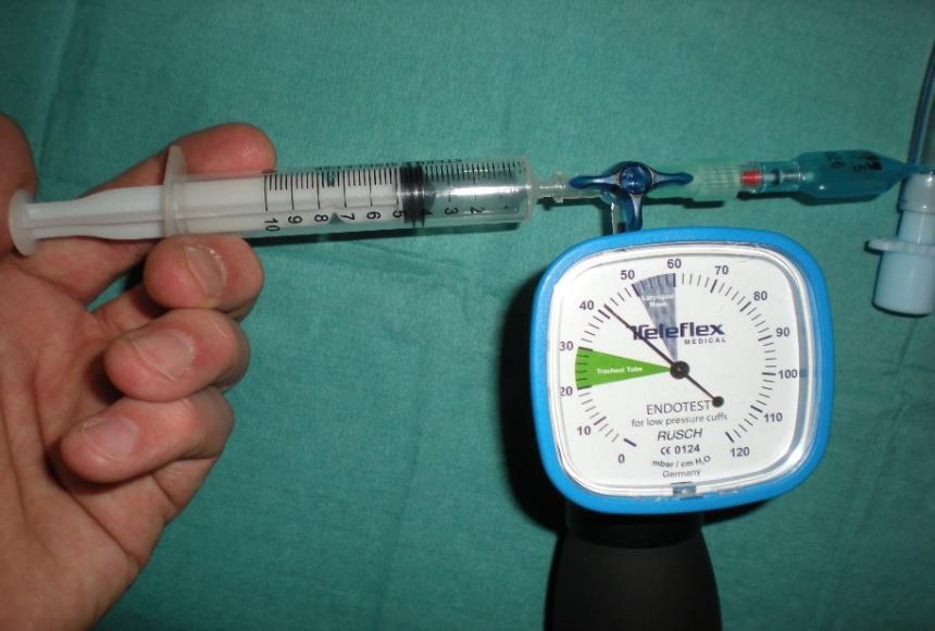Slika 17: Prikaz meritve tlaka v mešičku dihalne cevke z profesionalnim merilcem Vir: Radolič, 2015 Tabele 1 do 36 prikazujejo povprečne vrednosti meritev, standardna odstopanja, minimalne in