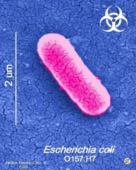 Slika 1: E. coli pod mikroskopom (Vir slike: http://www.bacteriainphotos.com/bacteria%20under%20microscope/gramnegative%20larger/e.coli%20o157%20h7.jpg) 2.2.2 Bacillus cereus Bacillus cereus je gram pozitivna aerobna bakterija iz rodu Bacillus.