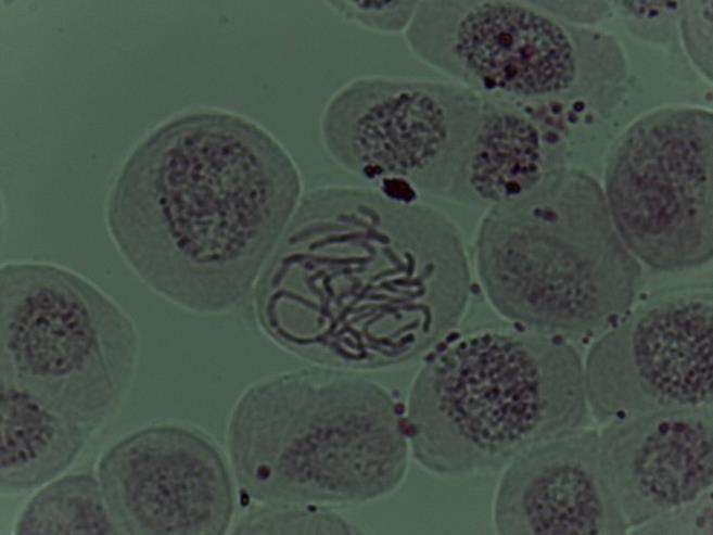 Slika 16:Profaza, koloidno srebro 20-25 ppm, 1000x povečava (lastni vir) Slika 17: Profaza in telofaza, koloidno srebro 20-25 ppm, 1000x