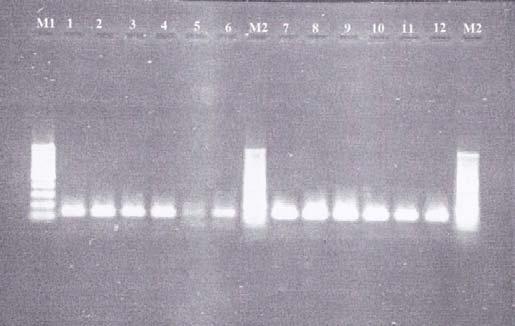 Kum K. Določanje bakterij rodu Alicyclobacillus s PCR v realnem času. 40 učinkovitost posamezne reakcije slaba. Dokazovanje pomnožkov bakterij vrste A. acidocaldarius, A. acidoterrestris in A.