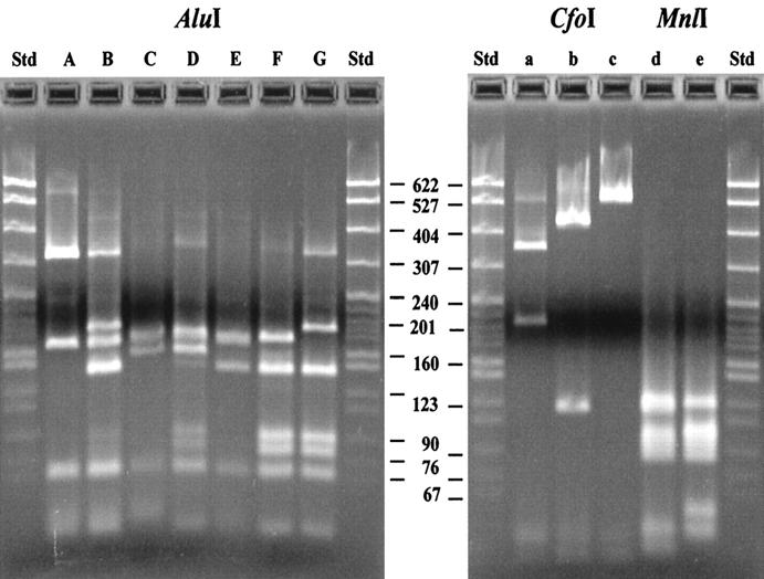 Tipizacijske tehnike PCR / RFLP restriction fragment length polymorphism - fragmente z restrikcijsko endonukleazo razrezanega