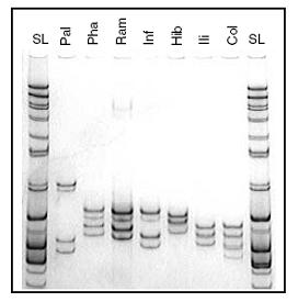 Tipizacijske tehnike PCR / SSCP single stranded conformation polymorphism Po denaturaciji pomnožka PCR se vsaka stran DNA zvije v